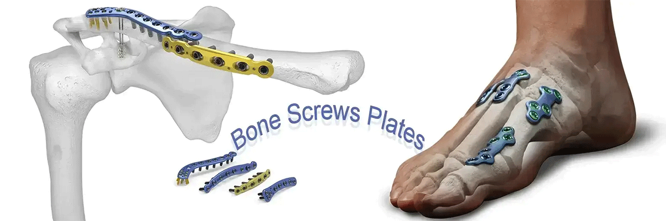 Bone Screws Plates